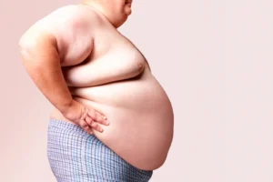 Millions eligible as NHS expands weight-loss jab access loss jab