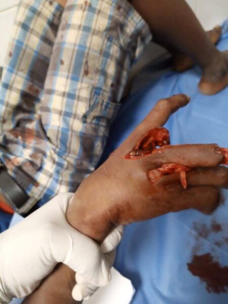 Police ban fireworks in Rivers