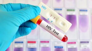 HIV test kit