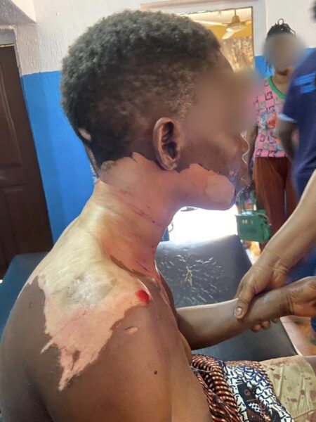 Police arrest husband for pouring hot oil on wife in Ogun