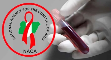 NACA calls for collaborative effort to tackle HIV prevalence rate in Taraba NACA