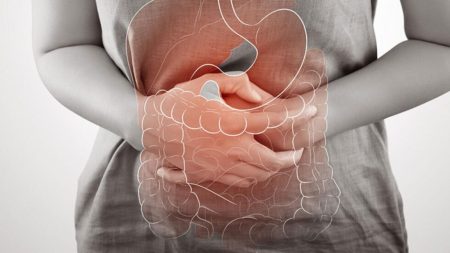Rising IBD cases tied to urban life, diet, common medications – Experts A woman holding her stomach due to IBD