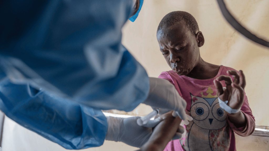 Mpox patient receiving treatment