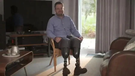 NHS surgeon  jailed after amputating own legs to claim £466,000 in insurance fraud surgeon Neil Hopper