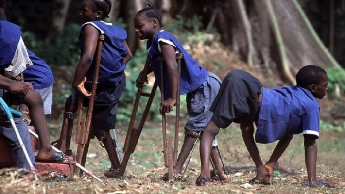 ‘Stigmatisation still hindering polio survivors’ participation in Bauchi’ The Physically Challenged Association in Bauchi State has raised concern over the persistent stigmatisation faced by polio survivors, saying the situation continues
