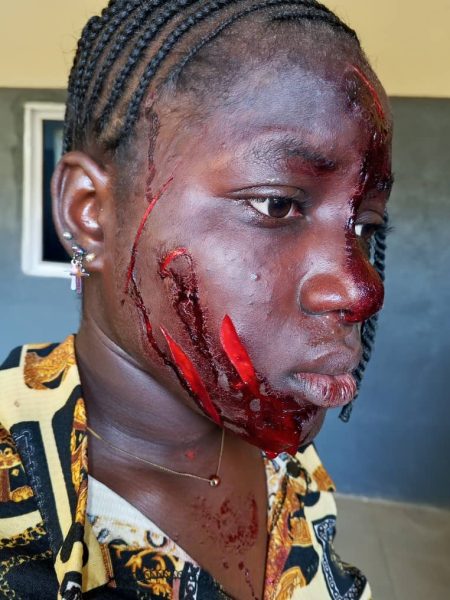 Iwasen Terhemba attack by the woman