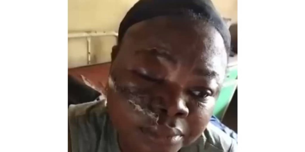 Residents demand probe over injured APC Women leader in Kogi Residents of Iffe-Ijumu in Ijumu Local Government Area of Kogi State have demanded an urgent investigation after Iyabo Iwamofe, the All Progressives Congress